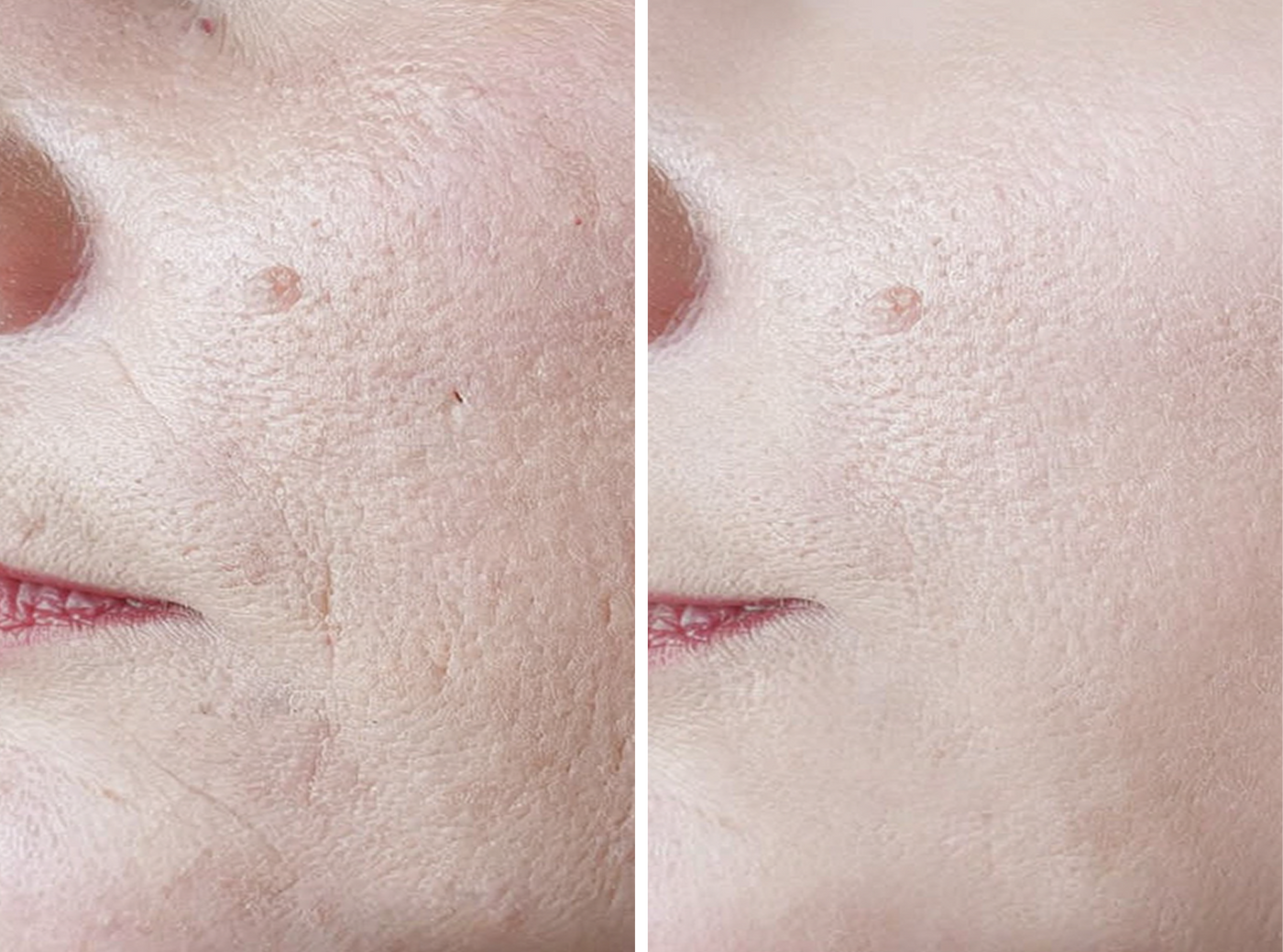 Regain firm and elastic skin