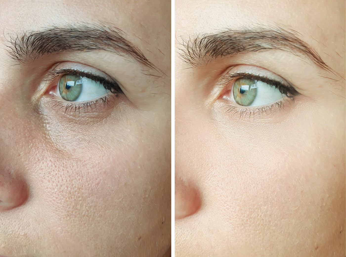 Increase Blood Circulation