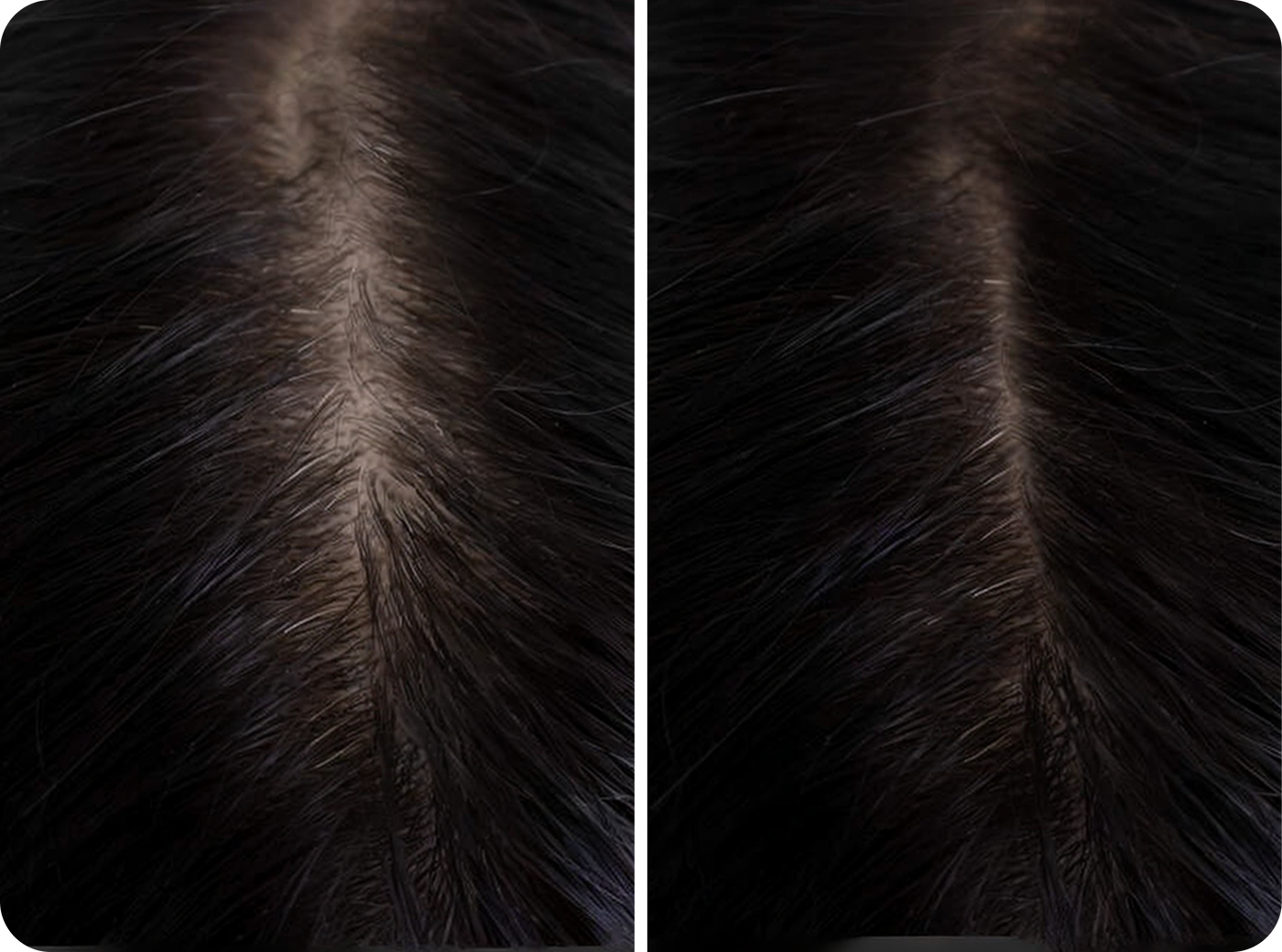 Skin Vitality for Hair Growth